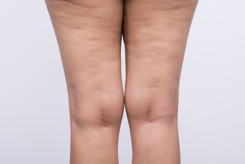 stylepuls12